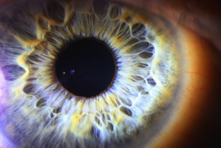 Карие глаза под микроскопом голубые