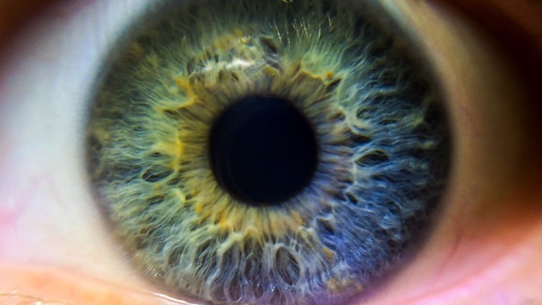 Сурен Манвелян глаза