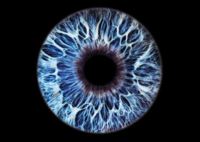 Ирис Радужная оболочка глаза