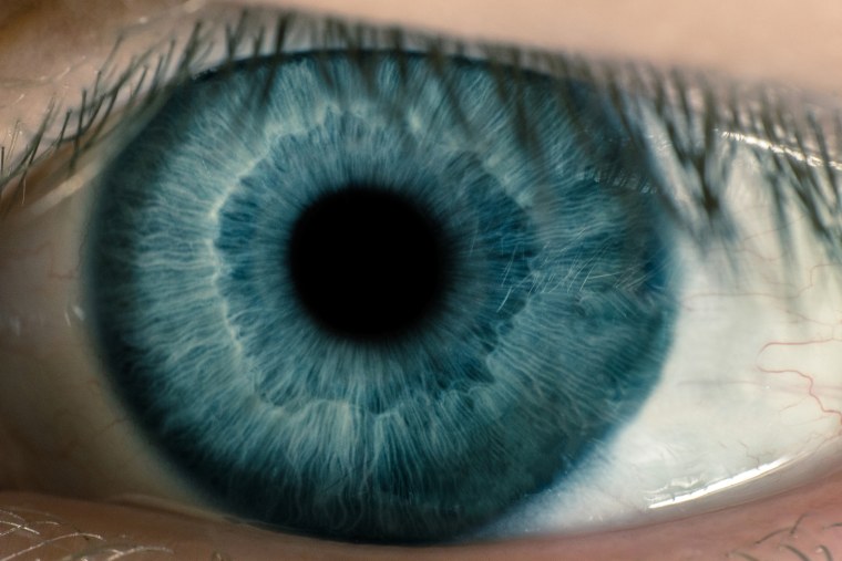 Сурен Манвелян глаза