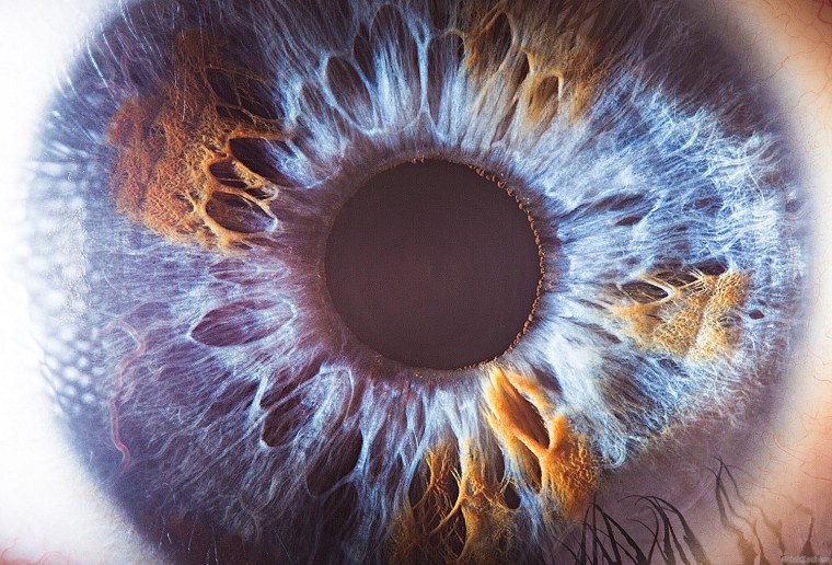 Окантовка Радужки глаза