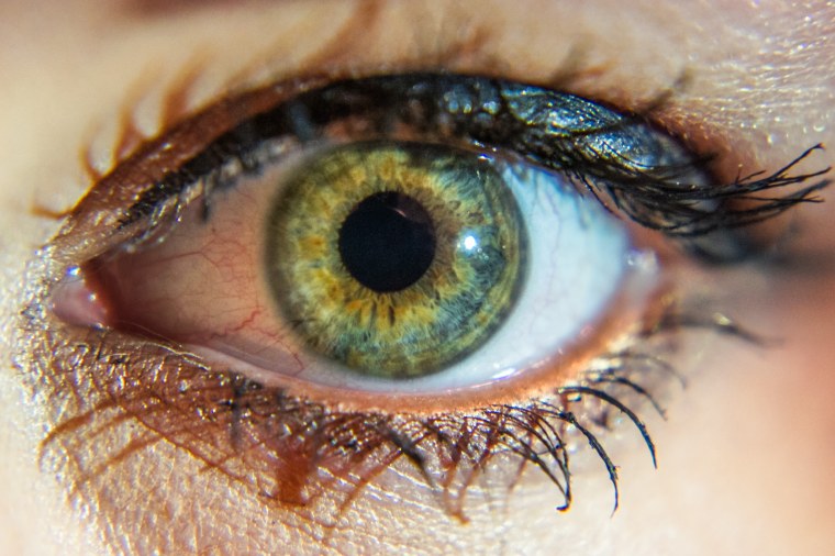 Желтые глаза