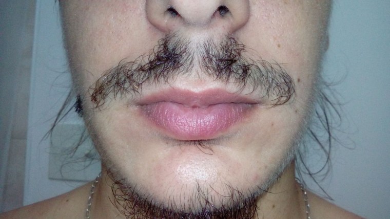 Миноксидил усы