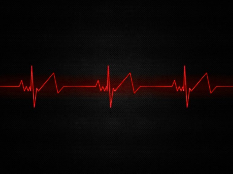 ЭКГ на черном фоне