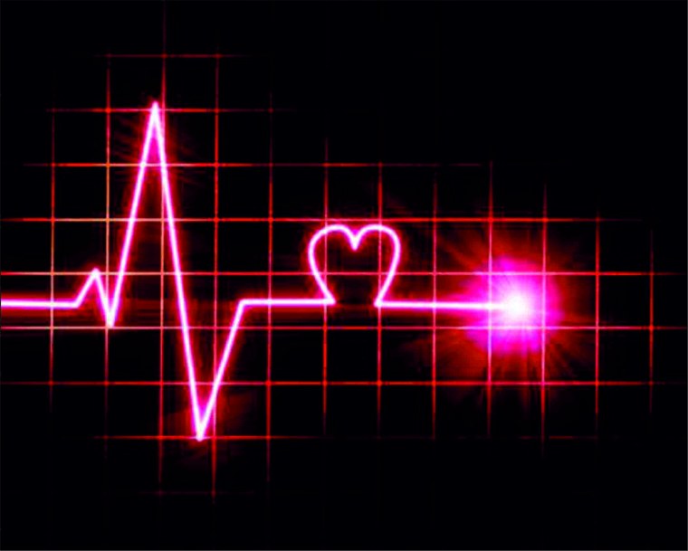 Кардиограмма сердца