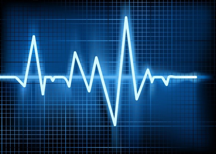 Биение сердца кардиограмма