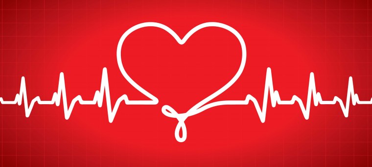 Кардиограмма учащенного сердцебиения