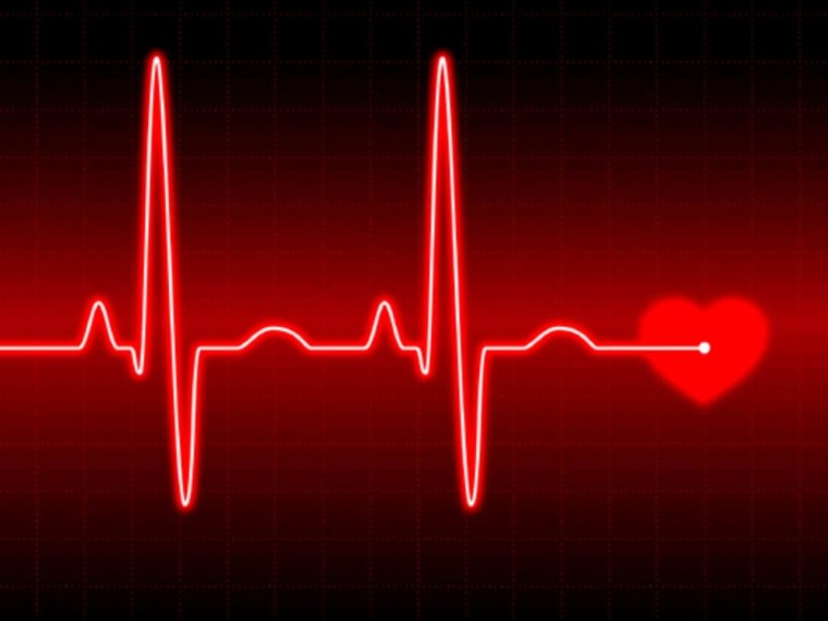 Сильное сердцебиение