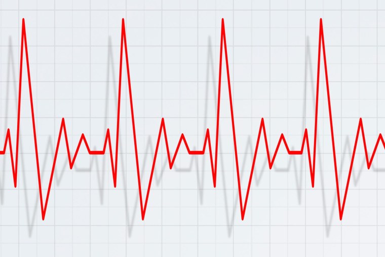 Диаграмма пульса