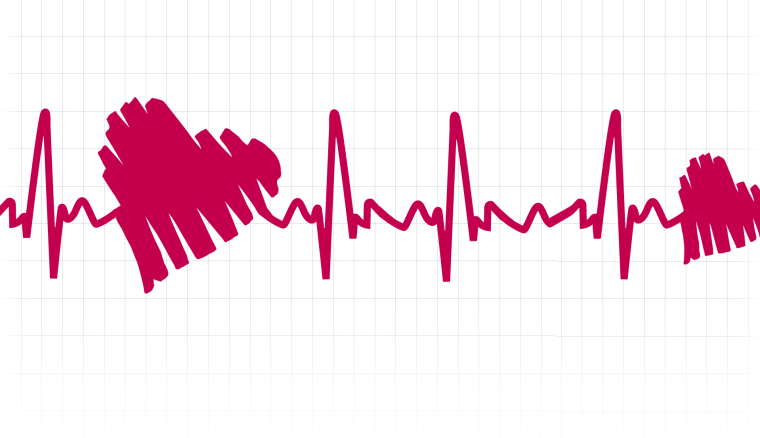Пульс вектор