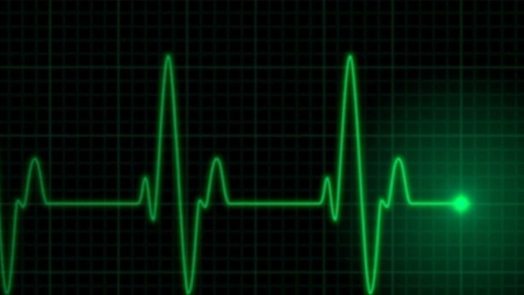 График сердцебиения