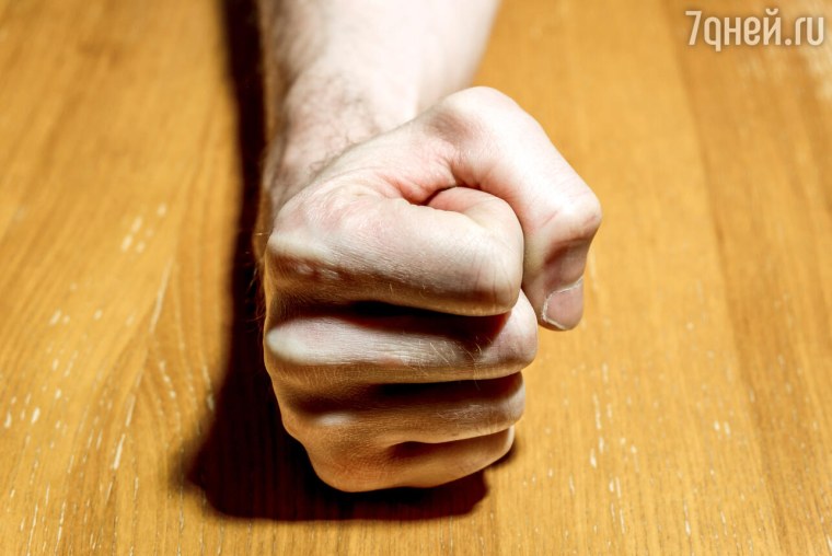 Фрэнк МАКГРАТ предплечье