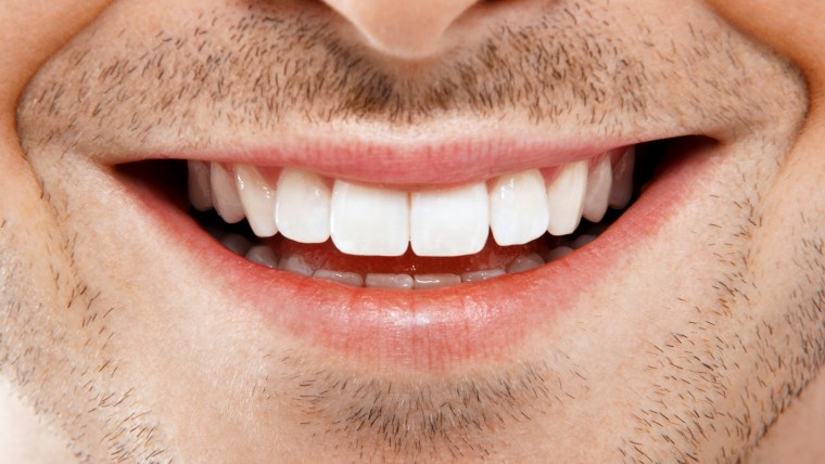 Красивые зубы