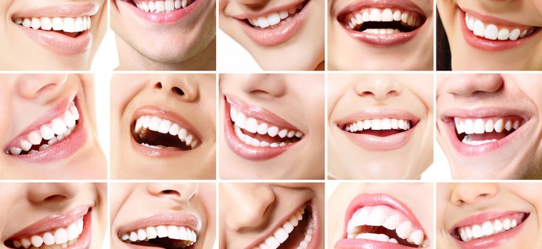 Красивая улыбка