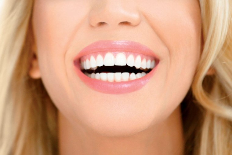 Красивые ровные зубы