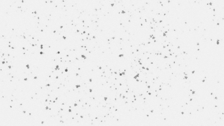 Веснушки текстура