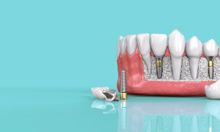 Стоматология баннер