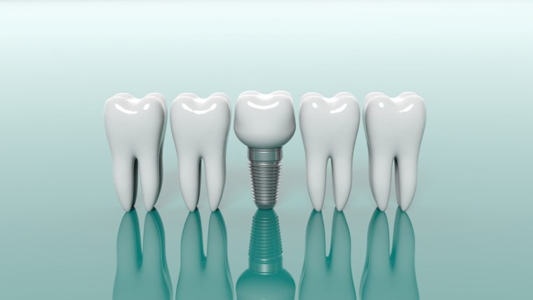 Красивые зубы