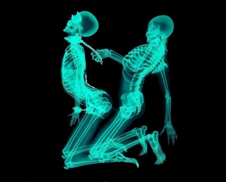 Рентген человека