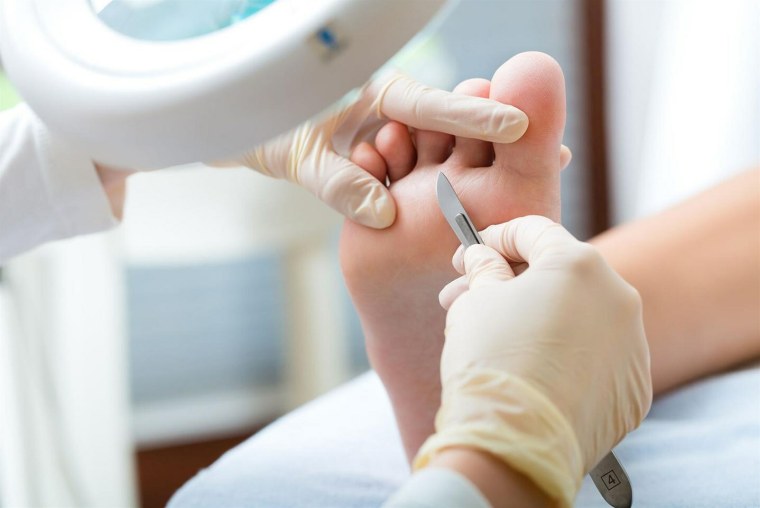 Медицинский аппаратный педикюр