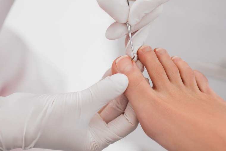 Медицинский педикюр ноги