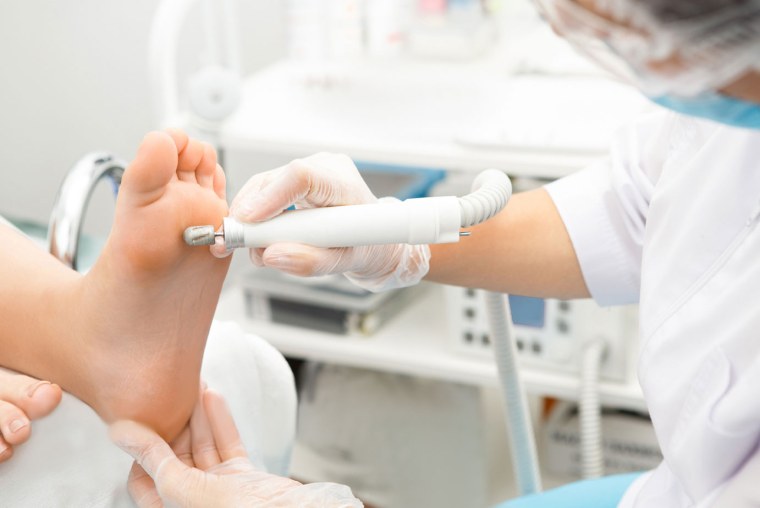 Аппаратный педикюр процесс