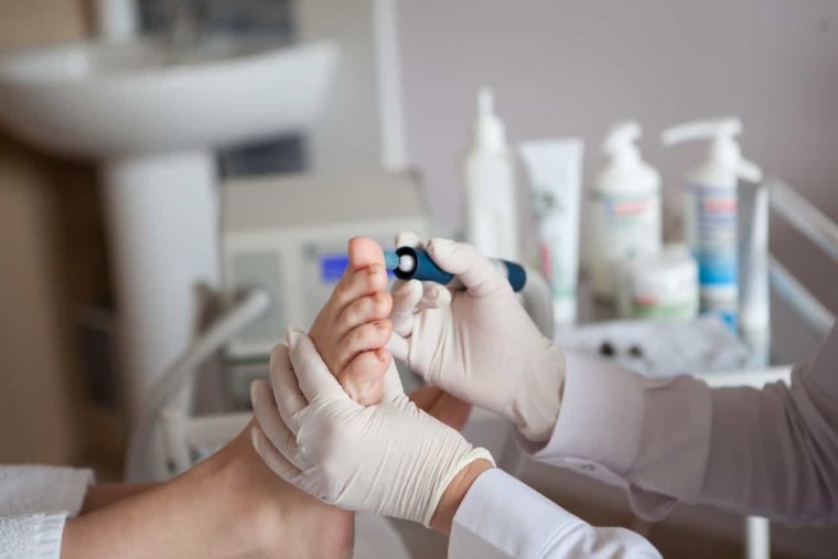 Аппаратный педикюр