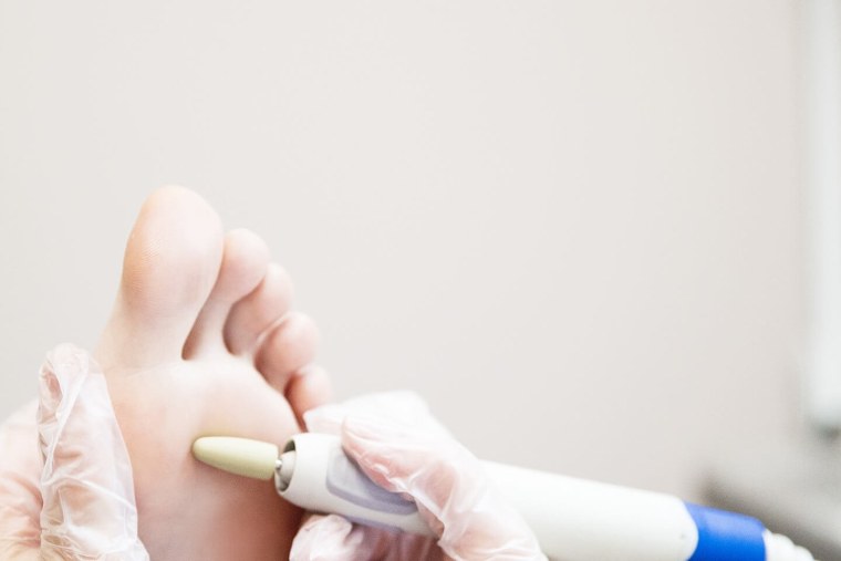 Аппаратный педикюр