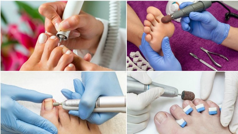 Гигиенический педикюр