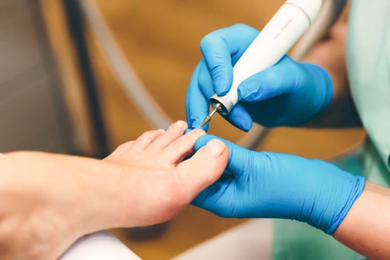 Диабетический педикюр