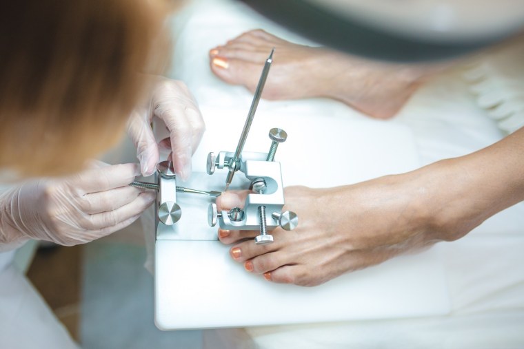 Аппаратный педикюр