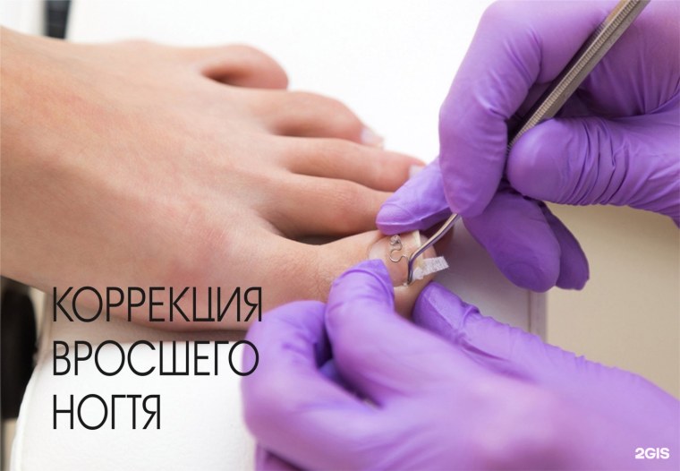 «Медицинский аппаратный педикюр» «Челны-ТВ 24» (КВД).