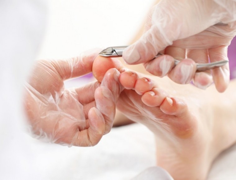 Аппаратный педикюр