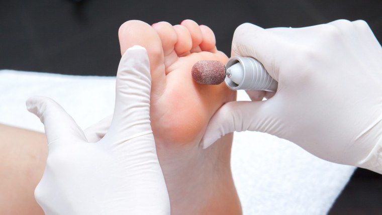 Аппаратный педикюр