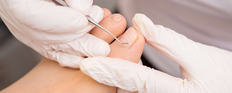 Подология аппаратный