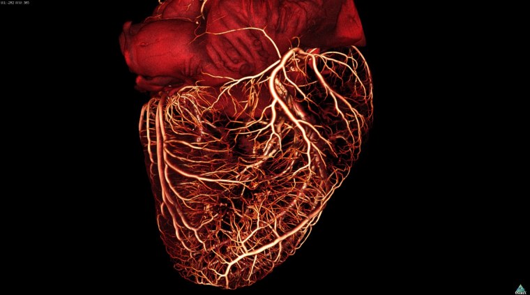 Анатомическое сердце Минимализм