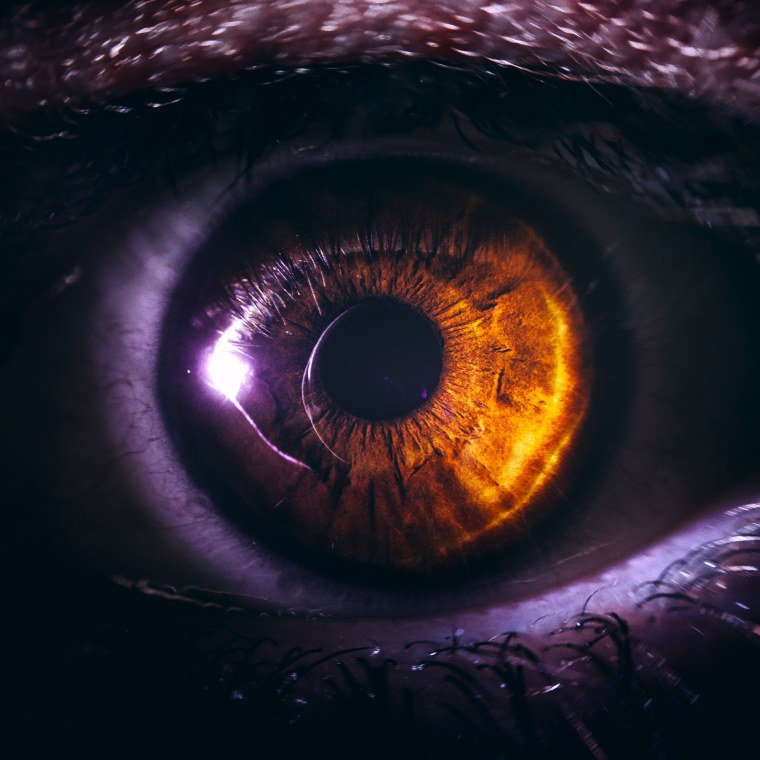 Красные глаза Эстет ка