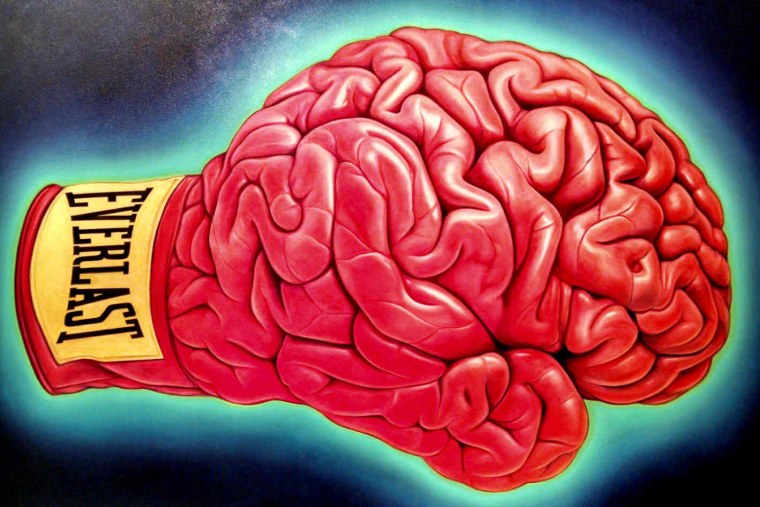 Бульбарная дизартрия очаг поражения