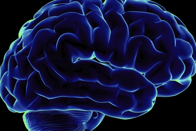 Изображение мозга