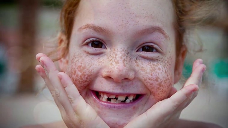 Рыжие дети с веснушками