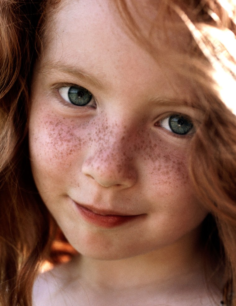 Дети с веснушками