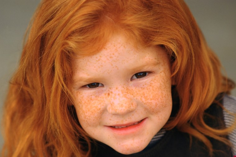 Светлана Иванова веснушки