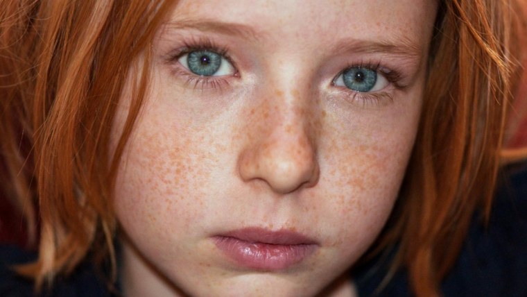 Рыжие дети с веснушками
