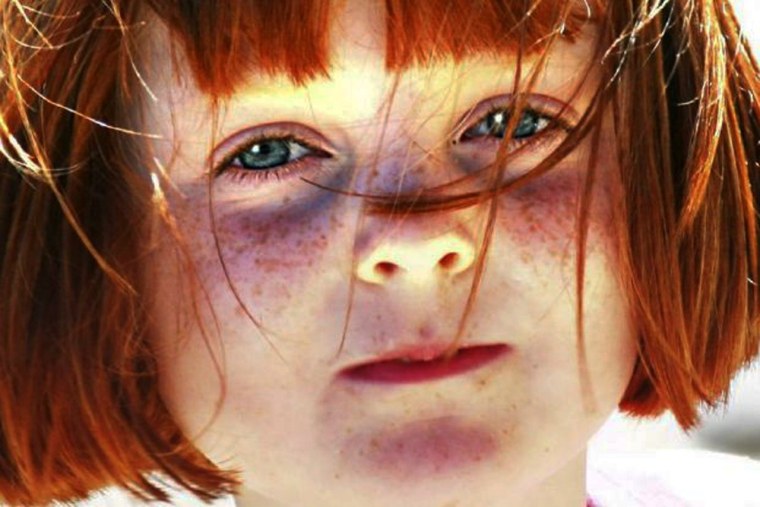 Рыжий рыжий конопатый девочка