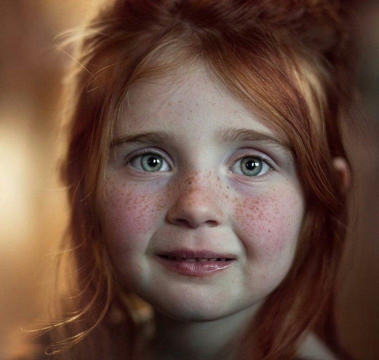 Дети с веснушками