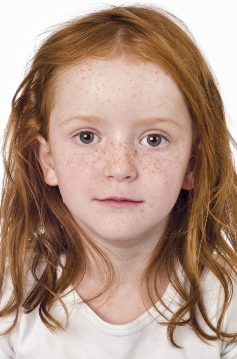 Дети с веснушками