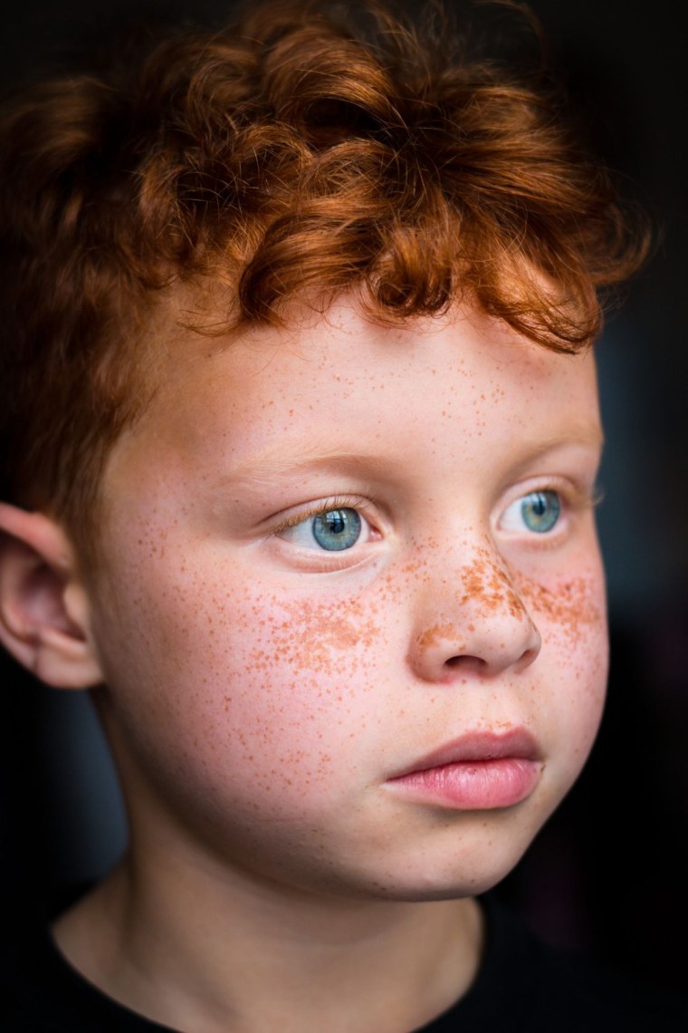 Дети с веснушками