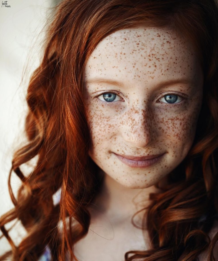 Freckles Эвелина Лашук