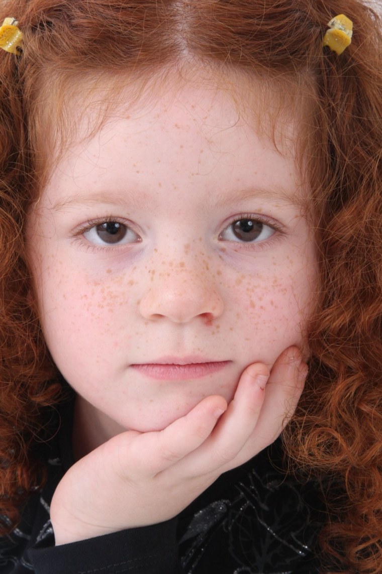 Дети с веснушками