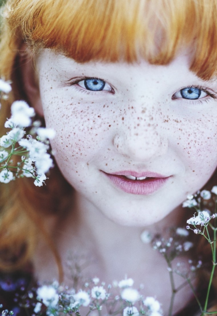 Дети с веснушками